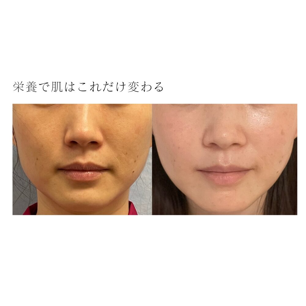 紹介画像
